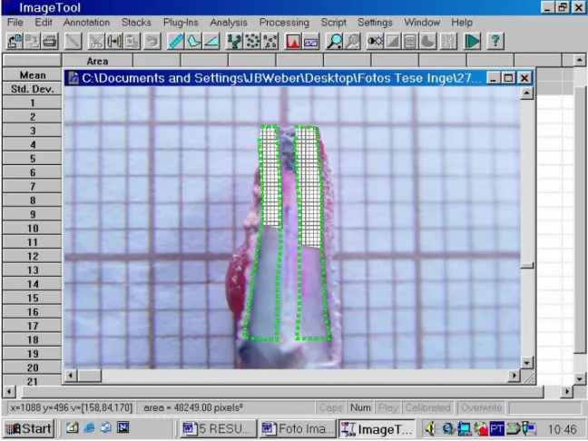 Figura 3 - Imagem digitalizada no software Image Tool ® , com MTA ProRoot ® Fonte: dados da pesquisa (PUCRS; 2005) 