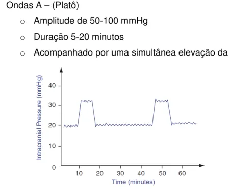 Figura 4 – Ondas A de Lundberg – Pressão Intracraniana (mmHg) versus Tempo (minutos) (ADAMS,  BELL,MCKINLAY, 2010) 