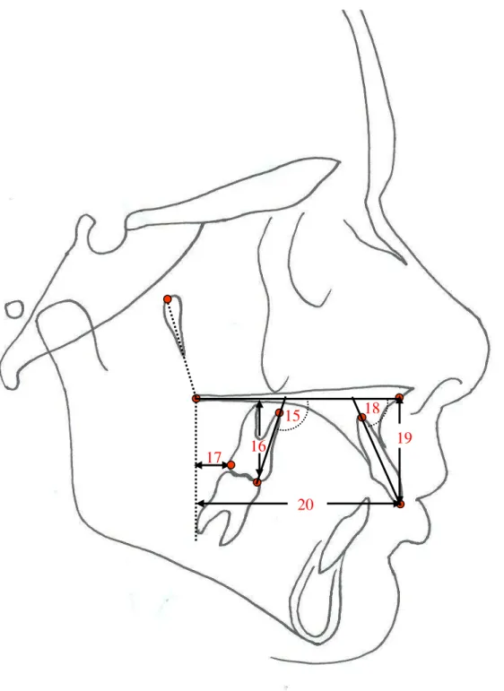 Figura 12: Medidas cefalométricas de molares e incisivos. 16 17 15  18 20  19 