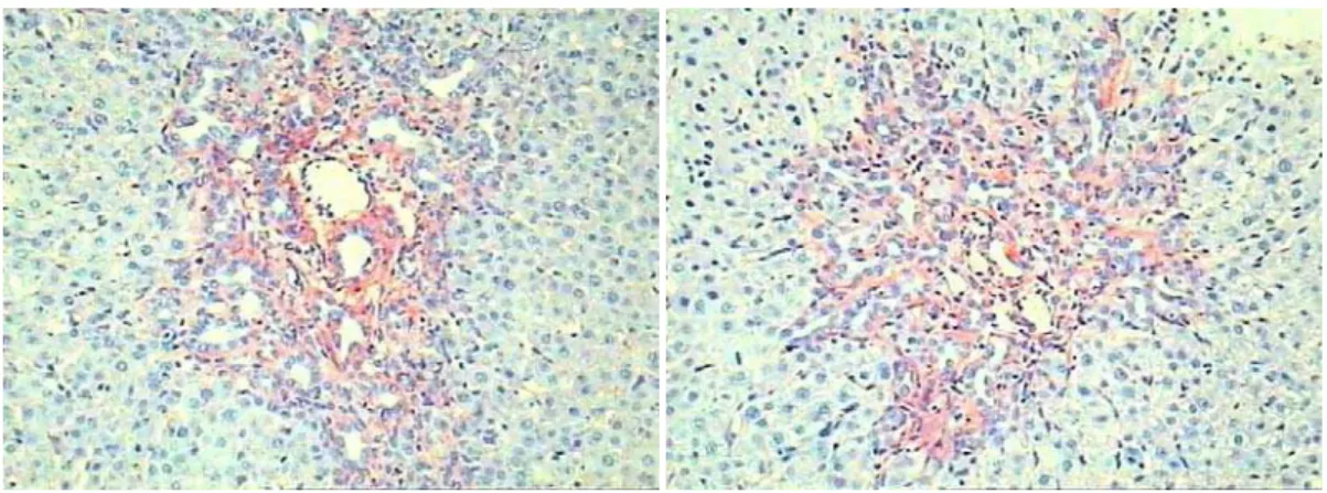 Figura 14. Microfotografias de lâminas de fígado dos animais do grupo PTX _ à  esquerda: 15 dias após ligadura biliar / à direita: 30 dias após ligadura biliar  (coloração picrossírius / aumento de 200x) 