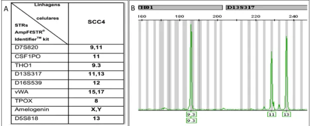 Figura  5.1  –  STRs utilizados para  caracterização  de  linhagens  celulares. (A)  Padrão  de  STRs  esperados  para  a  linhagem  SCC4  (B)  Representação  dos  loci  de  STRs  THO1  e  D13S317 identificados em SCC4.