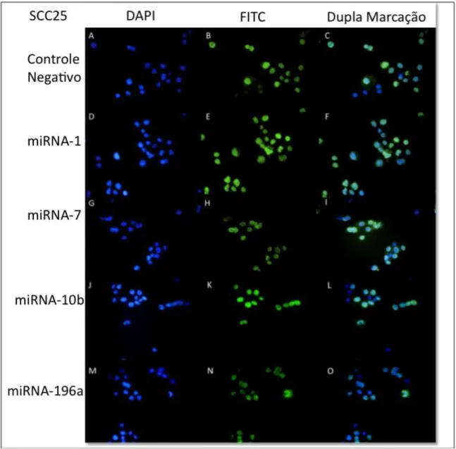 Figura  5.13  -  Representação  de  um  campo  visual  do  microscópio  para  avaliação  da  proliferação  celular  por  imunofluorescência  (detecção  de  Ki67)  em  SCC25  após  transfecção  com  precursores de miRNAs