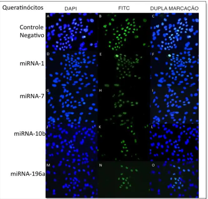 Figura  5.15  -  Representação  de  um  campo  visual  do  microscópio  para  avaliação  da  proliferação  celular  por  imunofluorescência  (detecção  de  Ki67)  de  queratinócitos  após  transfecção  com  precursores  de  miRNAs