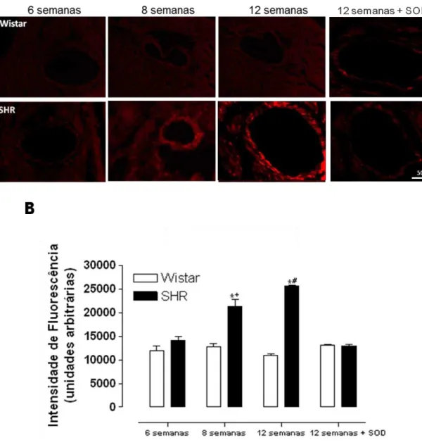 Figura 6 - Geração de EROs em artérias coronárias de animais Wistar e SHR  com 6, 8 e 12 semanas