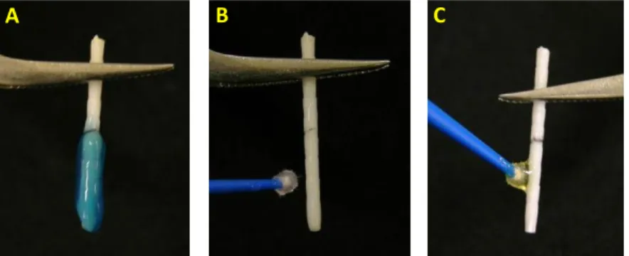 Figura 4 - A) Limpeza do pino de fibra de vidro com gel de  ácido  fosfórico  a  35%,  por  20  segundos