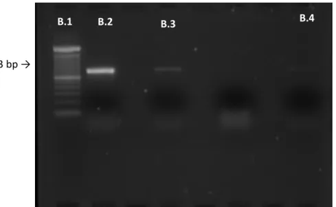Figura 2  –  PCR uniplex para identificação do gene de resistência tetB em três cepas  de  E  coli
