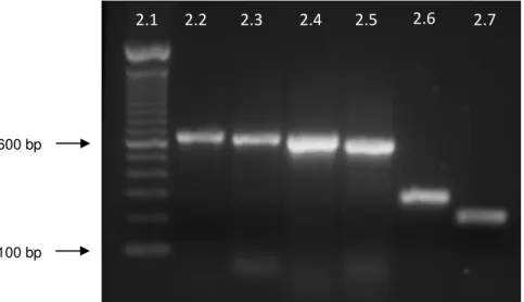Figura 2 – PCR uniplex para identificação dos genes de resistência antimicrobiana  tet(M),  erm(A),  erm(B),  aph(3’)-IIIa,  ant(6)-Ia e  aac(6’)-Ie-aph(2’’)-Ia