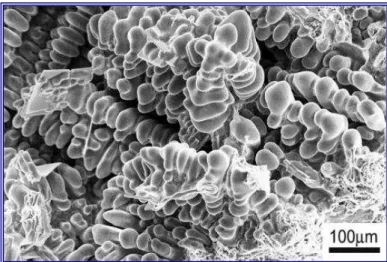 Figure  4:  Solidification  dendrites  of  an  aluminum  alloy  with  high  silicon  content  (Milan,  2004)