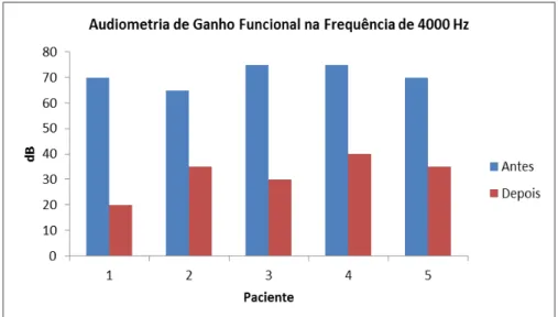 Figura 11 - Audiometria de Ganho Funcional na frequência de 4000 Hz. 