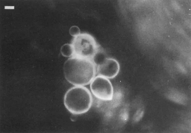 Figura 3.1: Foto de célula de P. brasiliensis com múltiplos brotamentos. Esse for- for-mato é conhecido como “roda de leme”