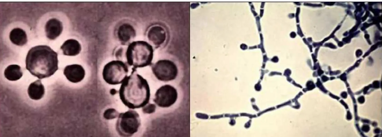 Figura 3.2: As duas formas do P. lutzii, micélio (a direita) e levedura (a esquerda) Após a instalação existem duas formas básicas de apresentação da doença: