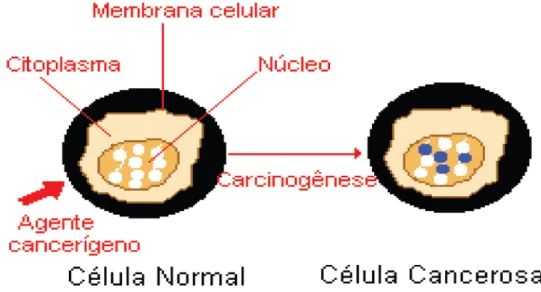 Figura 1 - Transformação de uma célula normal em célula cancerosa 
