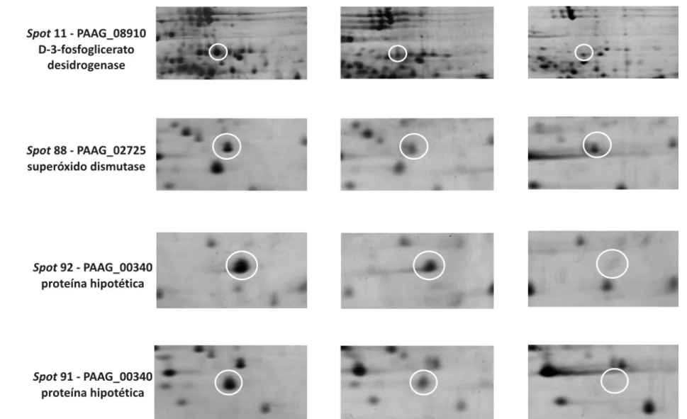 Figura 11 – Ampliação da área dos spots mostrando as diferenças na expressão da proteína entre as três condições analisadas: micélio, transição de micélio para  levedura e levedura