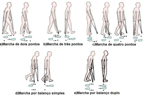 Figura 1 – Tipos de marchas com muletas. As figuras (a),(b) e (c) represent˜ao os tipos de marcha de suporte, as figuras (d) e (e) represent˜ao os tipos de marcha de suspens˜ao, adaptado de (ROGERS, 2014) .
