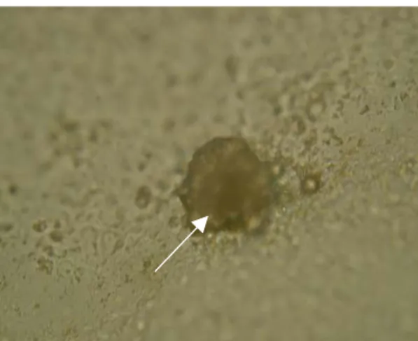 Figura 6- Embrião D14 proveniente de  cultivo sob óleo óleo mineral normal. A  seta indica a possível região do disco  embrionário