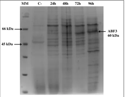 Figura  10  –  Perfil  eletroforético  em  gel    SDSPAGE  13%  de  proteínas  secretadas  por P