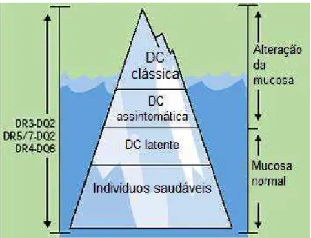 Figura 1: Iceberg Celíaco 