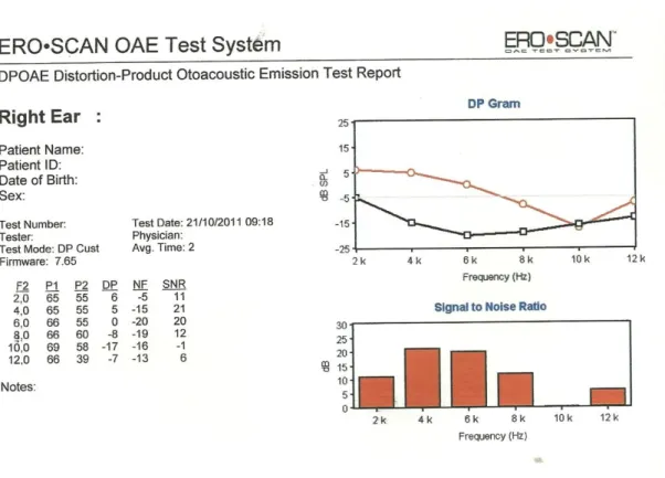 Figura 4  –  Modelo de exame de EOAPD  “Falha”