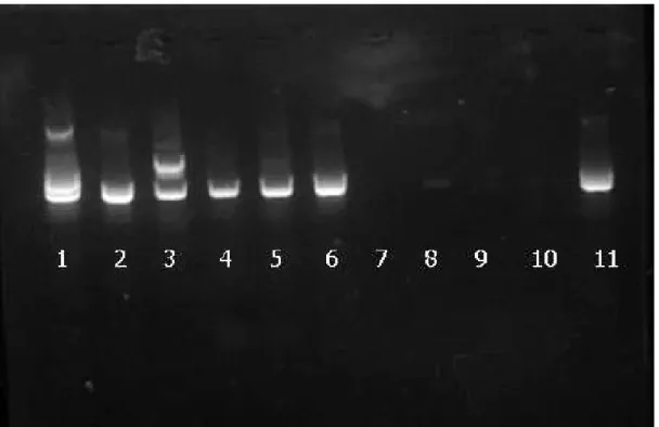 Figura 1: Resultado da M-PCR para a detecção do DNA do BoHV-5 em gel de agarose a 2% de amostras da Universidade de Brasília