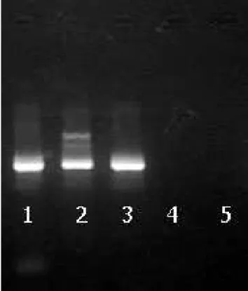 Figura 2: Resultado da M-PCR para a detecção do DNA do BoHV-5 em gel de agarose a 2% das amostras da Universidade Estadual de Londrina