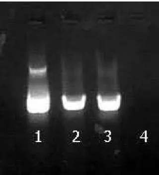 Figura 3: Resultado da M-PCR para a detecção do DNA do BoHV-5 em gel de agarose a 2% das amostras do matadouro