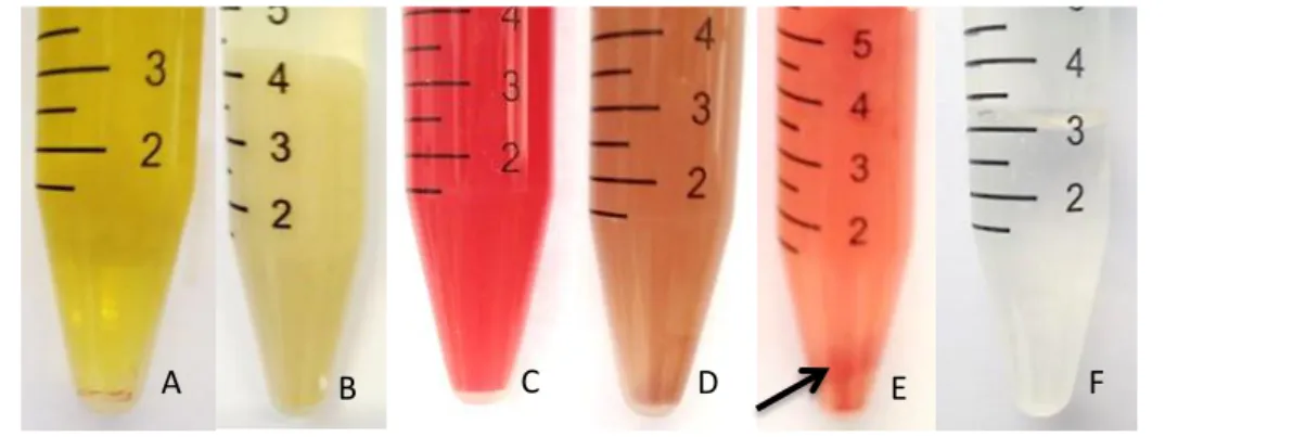 Figura  2.  Diferentes  aspectos  e  tipos  das  amostras.  (A)  amarelo  citrino,  líquido  ascítico