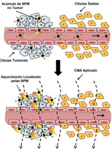 Figura 15. Magnetohipertermia no tumor gerada pelo uso de nanopartículas magnéticas (NPM)  quando  submetidas  a  um  campo  magnético  de  frequência  alternada  (CMA)  (COLE;  YANG; 