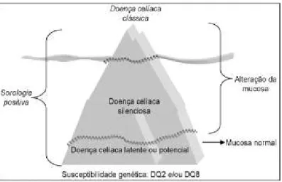 Figura 3: Manifestações clínicas da doença celíaca: Iceberg da Doença Celíaca. Fonte: Dra