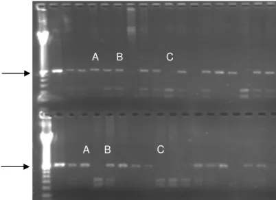 Figura  10.  Gel  de  agarose  1,5%  mostrando  os  resultados  da  digestão  dos  fragmentos  amplificados para os  loci  Hind III IVS-2  G γ e Hinc II ψβ1