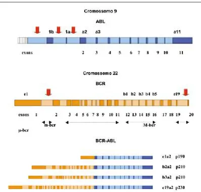Figura 2: Representação esquemática dos genes ABL e BCR na t (9,22 (q34;q11). Os exons estão representados  pelas cores azul e laranja escuros nos genes ABL e BCR, respectivamente e os introns pelas cores azul e laranja  claros