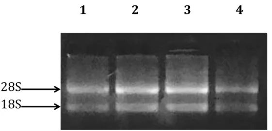 Figura 5. Imagem ilustrativa do perfil eletroforético do RNA extraído de células OSCC-3 em 2h
