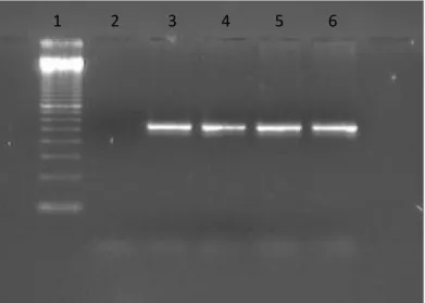 Figura 5: Resultado da amplificação do exon 2 do gene ROR2. 1- Marcador de peso  molecular, 2- Controle negativo, 3-6 Amostras de pacientes 