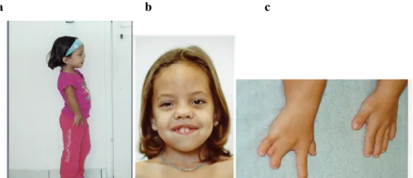 Figura 23: Imagens a/b/c da paciente 8 aos 10 anos de idade 