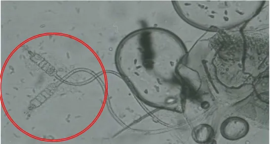 Figura  8  Espermateca  dissecada  da  fêmea  de  Lutzomyia  whitmani,  fotodocumentada  em  Microscópio  Óptico  Zeizz  Axiolab  com  aumento  de  400x