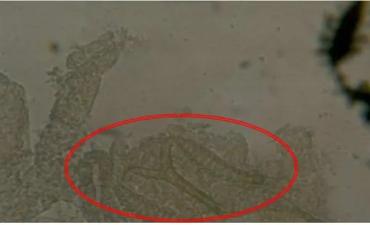 Figura  10  Espermateca  dissecada  da  fêmea  de  Lutzomyia  davisi,  fotodocumentada  em  Microscópio  Óptico  Zeizz  Axiolab  com  aumento  de  400x