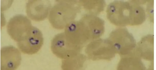 FIGURA 6: Babesia microti - coloração Giemsa