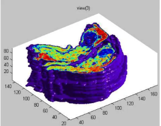 Figure 10. 3D reconstruction obtained for Case #4. 
