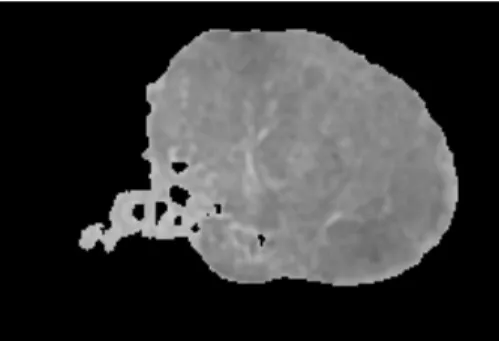 Figure 4. An experimental image in grayscale after been multiplied with the corresponding  segmentation tissue mask