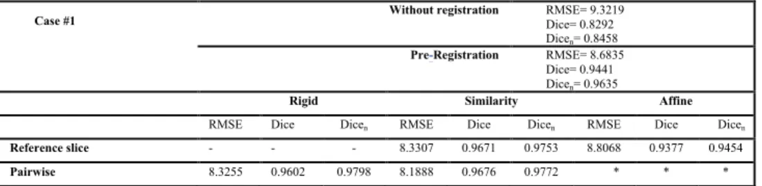 Table  2. Assessment  results  for  the  four  cases  under  study  regarding  the  accuracy  achieved  using  different  geometrical  transformations  (rigid,  similarity  and  affine)  and  a  reference  slice  or  pairwise  based  approach  on  the regi