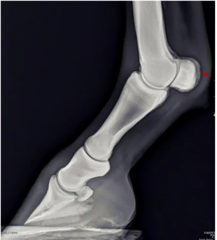 Figura 8: Imagem radiográfica - Projeção lateromedial  do  boleto  AE.  Quartela  longa  e  inclinada,  osteólise  palmar  dos  ossos  sesamoides  proximais  (seta)  (imagem gentilmente cedida pelo CIRALE)