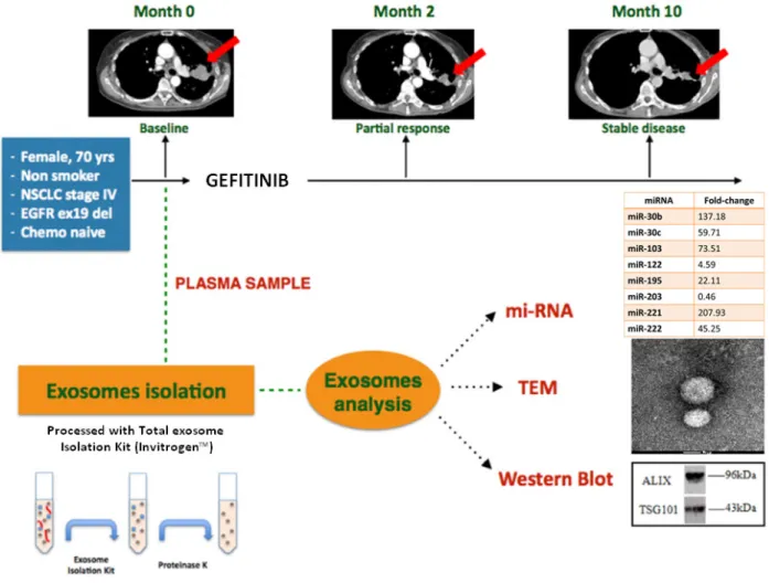 Figure 3: Summary of clinical case report.  The upper part of the figure shows the computerized tomography evolution