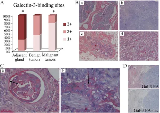 Fig. 6. Galectin-3-binding sites are downregulated in the ECM while expressed in tumor cell emboli in malignant CMT