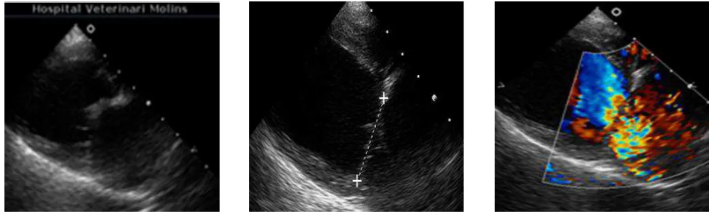 Fig. 4 e 5 imagens ecocardiográficas do Busta em modo B, evidenciando o engrossamento e irregularidades da válvula mitral e  o  seu  prolapso  para  o  átrio  esquerdo,  bem  como  marcado  aumento  das  câmaras  cardíacas  esquerdas
