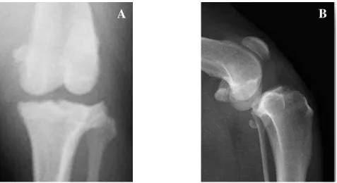 Fig.  1  Radiografia  da  articulação  do  joelho.  A)  Projecção  cranio-caudal.  É  visível  algum  grau  de  osteoartrose no sesamóide medial do fémur