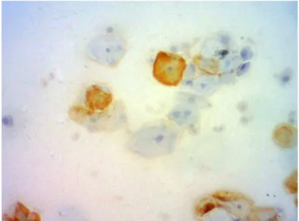 Figura  1  –  Células  epiteliais  escamosas  típicas  exibindo  expressão  citoplasmática  ou  ausência  de  expressão para BPV-1-1H8