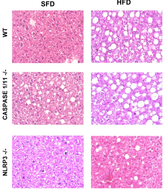 Figura  5:  Lâminas  hitológicas  de  fígados  de  animais  selvagens  (WT),  Caspase  1/11 -/-   e  NLRP3 -/- -/-submetidos  à  dieta  normolipídica  (SFD)  ou  hiperlipídica  (HFD)  por  3  meses