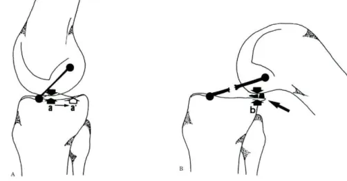 Fig. 7 — A: LCA íntegro. Representação dos pontos de contacto fémuro-tibial na extensão (a) e na flexão(á)