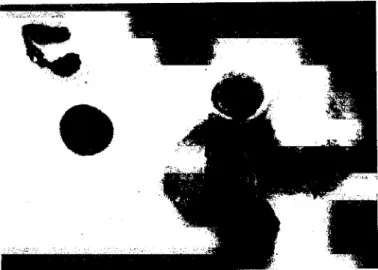Fig. 1. Light microscopy of a Wright-stained cytospin preparation of peritoneal leucocytes,  showing one neutrophil with a multilobulated nucleus, two macrophages (large mononuclear  cells) and 3 lymphocytes (small mononuclear cells), x 1000