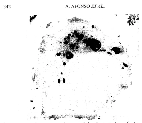 Fig. 6. A macrophage in a sample processed for ultrastructural cytochemistry for acid  phosphatase