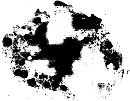 Fig. 3. Neutrophil in the peritoneal exu­